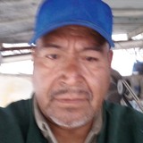 Halconjpachewq from Puebla de Zaragoza | Man | 64 years old | Cancer