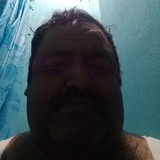 Rm56I from Iztapalapa | Man | 45 years old | Cancer
