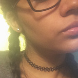 Alexis from Carmel | Woman | 30 years old | Cancer